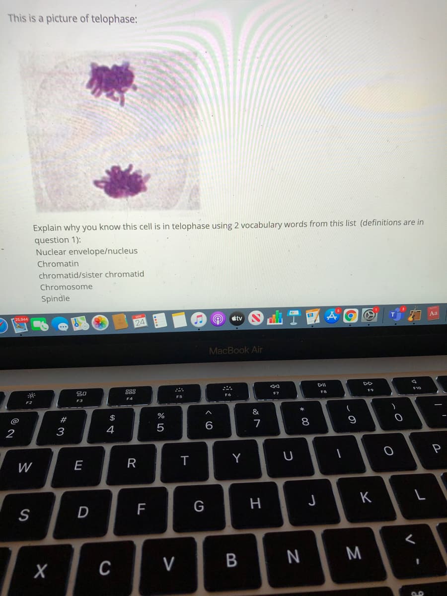 This is a picture of telophase:
Explain why you know this cell is in telophase using 2 vocabulary words from this list (definitions are in
question 1):
Nuclear envelope/nucleus
Chromatin
chromatid/sister chromatid
Chromosome
Spindle
r25.044
tv
Aa
24
MacBook Air
888
F7
FB
F9
F5
F6
F3
F4
F2
$
%
&
@
2
4
6.
7
P
W
E
T
Y
D
F
G
H
K
S
C
V
N
* C0
B
R
* 3
