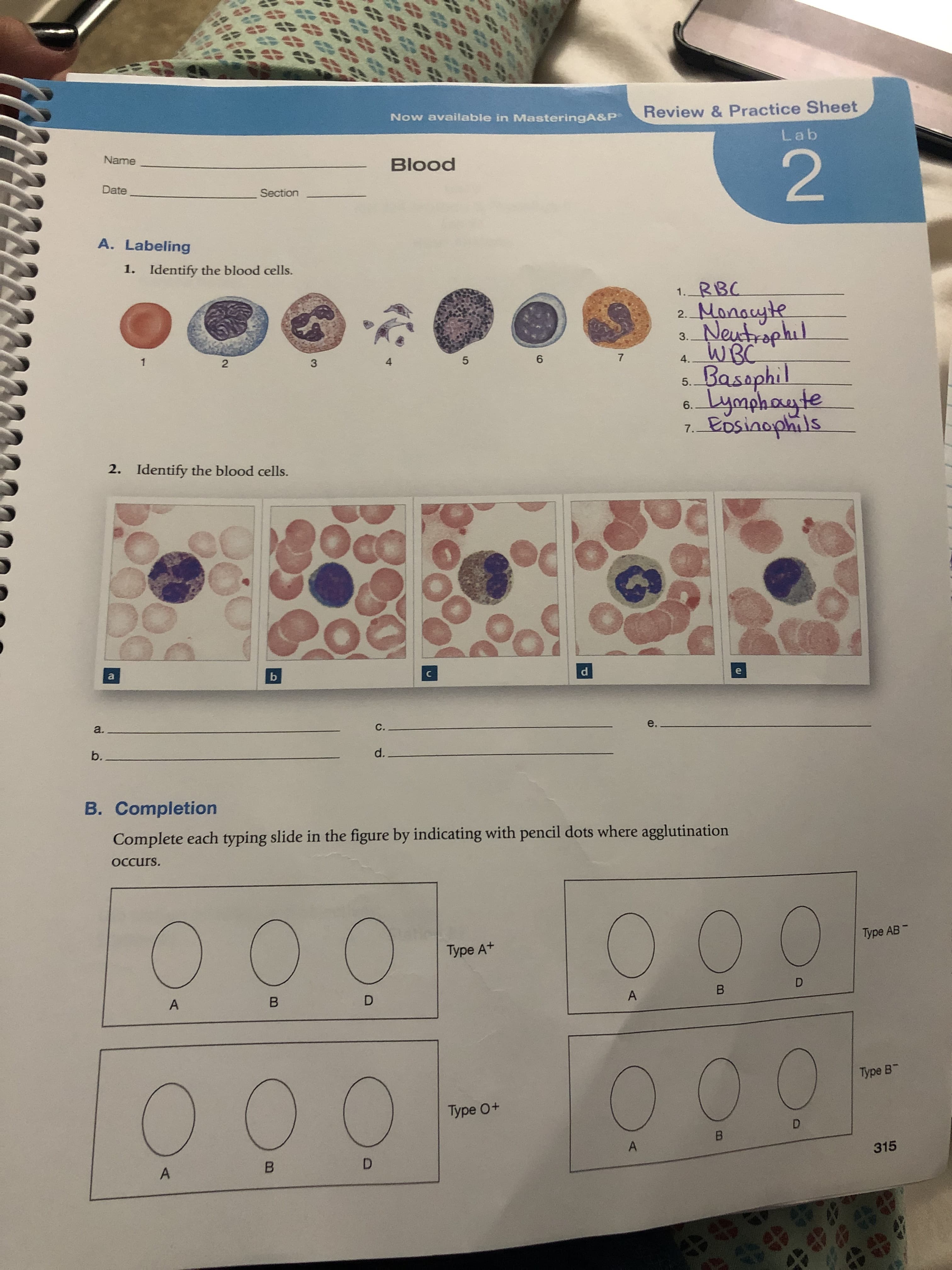 Now available in MasteringA&P
Review & Practice Sheet
Lab
Name
Blood
2
Date
Section
A. Labeling
1.
Identify the blood cells.
RBC
1.
Manauyle
Neutrophil
WBC
Basaphil
Lymphayte
Eosiaaphils
2.
3.
1
2
3
4
5
6
7
4.
5.
6.
7.
2.
Identify the blood cells.
a
b
a.
C.
e.
b.
d.
B. Completion
Complete each typing slide in the figure by indicating with pencil dots where agglutination
Occurs.
Type AB
Type At
A
B
D
B
A
Type B
Type 0+
D
B
A
D
315
B
A
# td
BP
4 d
ro
##4##
ef
0

