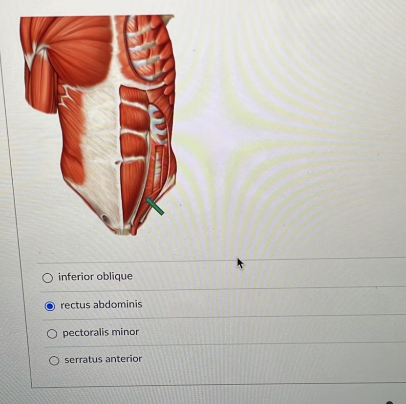 O inferior oblique
rectus abdominis
pectoralis minor
O serratus anterior