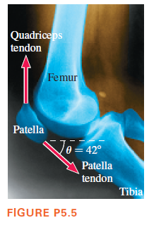 Quadrice ps
tendon
Femur
Patella
e = 42°
Patella
tendon
Tibia
FIGURE P5.5
