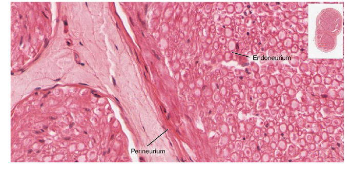 Endoneurium
Perineurium
