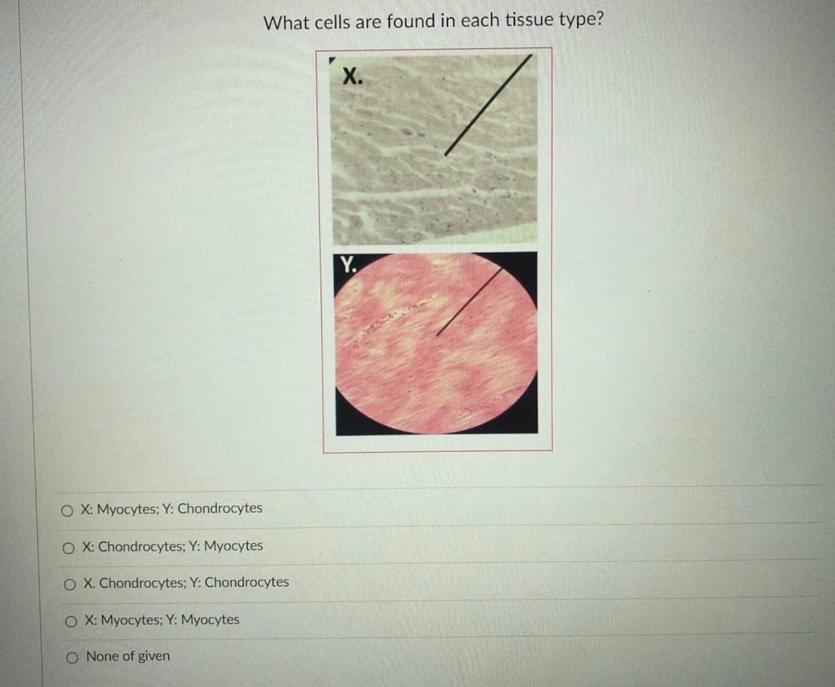 What cells are found in each tissue type?
X.
Y.
O X: Myocytes; Y: Chondrocytes
O X: Chondrocytes; Y: Myocytes
O X. Chondrocytes; Y: Chondrocytes
O X: Myocytes; Y: Myocytes
O None of given
