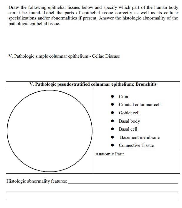 Draw the following epithelial tissues below and specify which part of the human body
can it be found. Label the parts of epithelial tissue correctly as well as its cellular
specializations and/or abnormalities if present. Answer the histologic abnormality of the
pathologic epithelial tissue.
V. Pathologic simple columnar epithelium - Celiac Disease
V. Pathologic pseudostratified columnar epithelium: Bronchitis
Histologic abnormality features:
Cilia
•
Ciliated columnar cell
•
Goblet cell
• Basal body
•
Basal cell
•
Basement membrane
Connective Tissue
Anatomic Part: