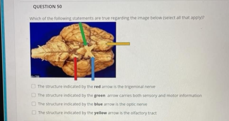 QUESTION 50
Which of the following statements are true regarding the image below (select all that apply)?
1720
The structure indicated by the red arrow is the trigeminal nerve
O The structure indicated by the green arrow carries both sensory and motor information
O The structure indicated by the blue arrow is the optic nerve
O The structure indicated by the yellow arrow is the olfactory tract
