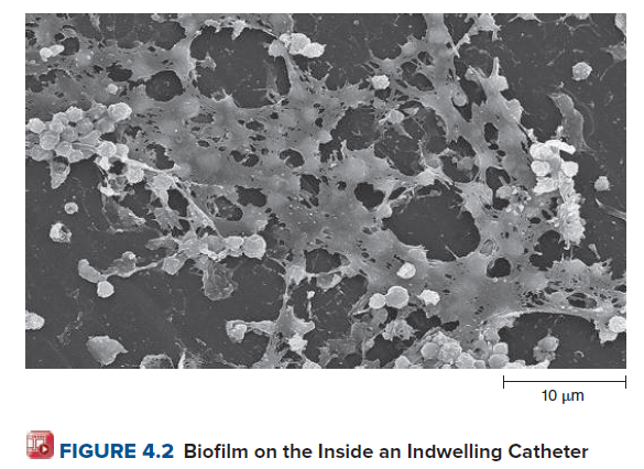 10 μη
FIGURE 4.2 Biofilm on the Inside an Indwelling Catheter
