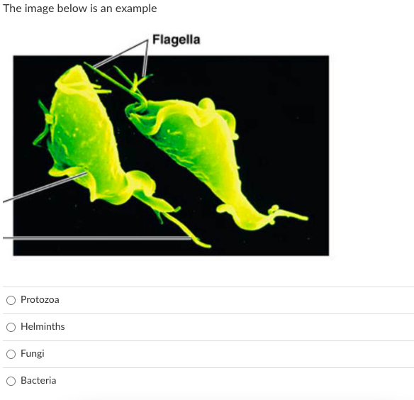 The image below is an example
Flagella
O Protozoa
O Helminths
O Fungi
O Bacteria
