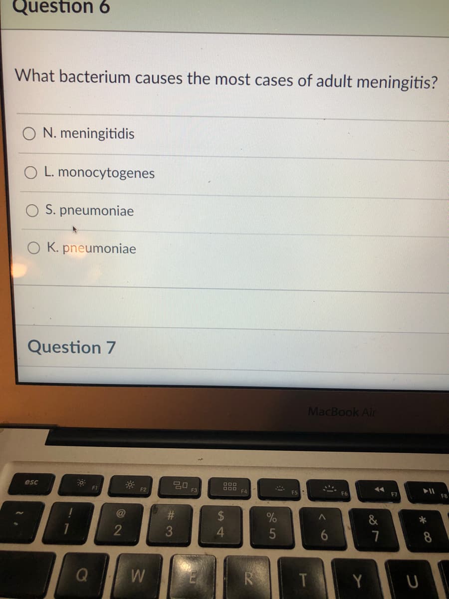 Question 6
What bacterium causes the most cases of adult meningitis?
N. meningitidis
O L. monocytogenes
S. pneumoniae
K. pneumoniae
Question 7
MacBook Air
esc
20
F3
F2
O00 FA
F5
F6
F7
F8
C@
%23
%24
4.
*
5
7
8
Q W
R
T Y U
6
