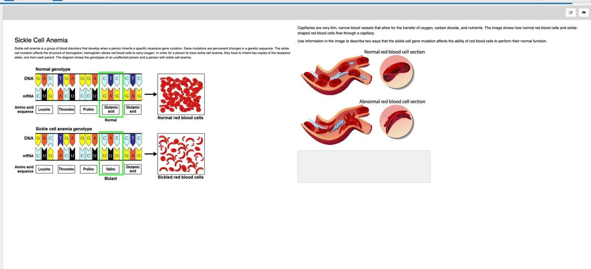 Sickle Cell Anemia
Sickle cell anemia is a group of blood disorders that develop when a person inherits a specific recessive gene mutation. Gene mutations are permanent changes in a genetic sequence. The sickle
cell mutation affects the structure of hemoglobin; hemoglobin allows red blood cells to carry oxygen. In order for a person to have sickle cell anemia, they have to inherit two copies of the recessive
allele, one from each parent. The diagram shows the genotypes of an unaffected person and a person with sickle cell anemia.
Normal genotype
DNA GAC TGA GGA CTC CTC
mRNA C||U|G| ACU CCUGAG GAG
Amino acid
sequence
Glutamic
acid
Leucine Threonine Proline
Sickle cell anemia genotype
DNA GAC TGAGGA CAC CTC
mRNA|C|U|G
Amino acid
sequence
Glutamic
acid
Normal
ACUCCU GUG GAG
Glutamic
acid
Leucine Threonine Proline
Valine
Mutant
38
Normal red blood cells
Car
nofil
Sickled red blood cells
Capillaries are very thin, narrow blood vessels that allow for the transfer of oxygen, carbon dioxide, and nutrients. The image shows how normal red blood cells and sickle-
shaped red blood cells flow through a capillary.
Use information in the image to describe two ways that the sickle cell gene mutation affects the ability of red blood cells to perform their normal function.
Normal red blood cell section
Abnormal red blood cell section