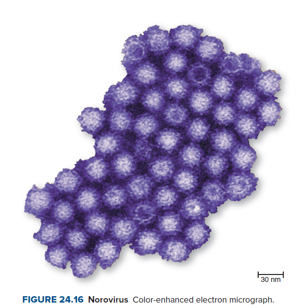 30 nm
FIGURE 24.16 Norovirus Color-enhanced electron micrograph.
