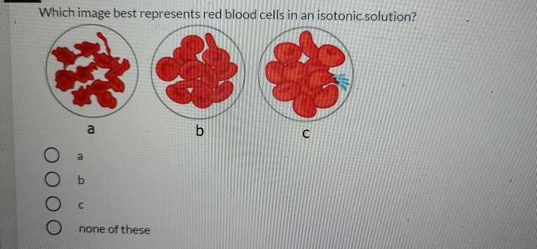 Which image best represents red blood cells in an isotonic.solution?
a
b
none of these
