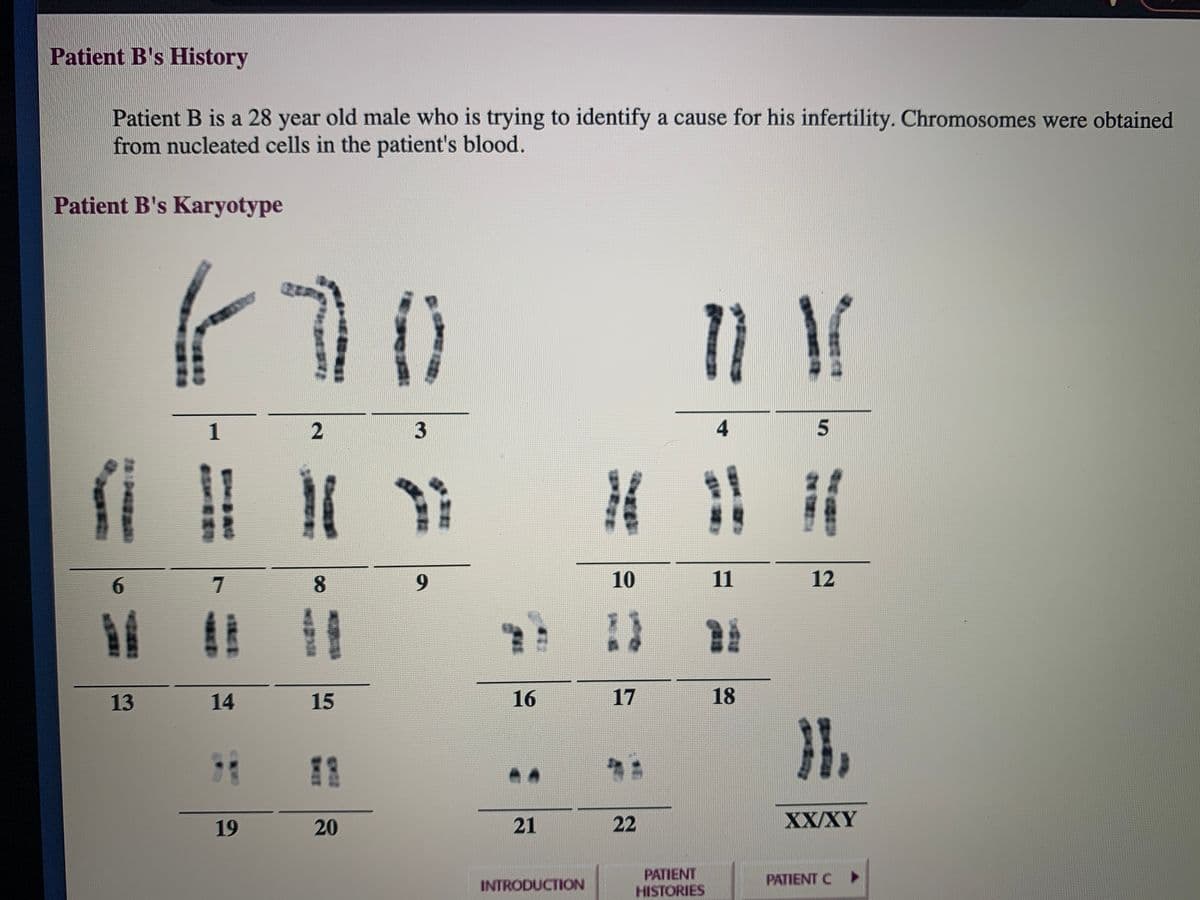 Patient B's History
Patient B is a 28 year old male who is trying to identify a cause for his infertility. Chromosomes were obtained
from nucleated cells in the patient's blood.
Patient B's Karyotype
1
3
寸
5.
6.
8.
6.
10
11
12
13
14
15
16
17
18
11
19
20
21
22
XX/XY
PATIENT
HISTORIES
INTRODUCTION
PATIENT C
ta pa
