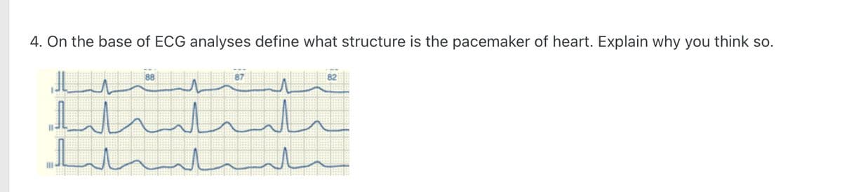 4. On the base of ECG analyses define what structure is the pacemaker of heart. Explain why you think so.
سلسلية
سليل
بليد