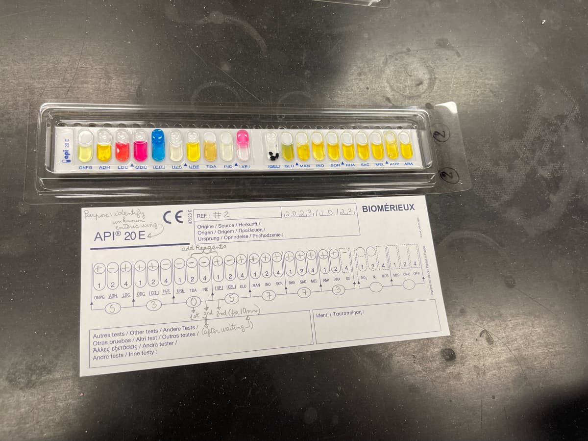 ONPG
ADH
LDC ODC
ODC LCIT
Purpose: identify
unknown
enteric using-
APIⓇ 20 E4
1
ONPG ADH LDC
5
DA++DO
9980
2
4
H25 URE
CE
-
TDA
add Reagents
REF.: #2
Origine/Source / Herkunft/
Origen/Origem/Пpočevan/
Ursprung / Oprindelse / Pochodzenie:
-
4
2.
1
1
2
4
URE TDA
ODC LCT HS
3
O
INDLVPI
IND
(+) (-)+
4
2
1
LVPJ LGELI GLU
5
IGEL GLUMAN
(+
(++++
1 2 4
MAN INO SOR
7
1st 3rd 2nd (for 10mm)
A
Autres tests / Other tests / Andere Tests /
Otras pruebas / Altri test / Outros testes/ (after waiting)
Άλλες εξετάσεις / Andra tester /
Andre tests / Inne testy:
INO SOR RHA
2,0,2,3,/ 11.0/12,7 BIOMÉRIEUX
++++
1 2 4
RHA SAC MEL
7
SAC MELAY ARA
2
1
AMY ARA
12
12
NO₂ N₂ MOB MCC OF-O OF-F
| Ident. / Ταυτοποίηση