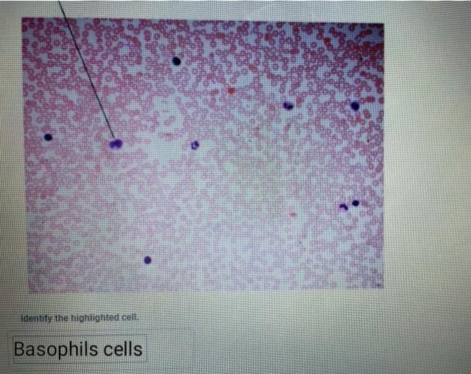 Identify the highlighted cell.
Basophils cells
19