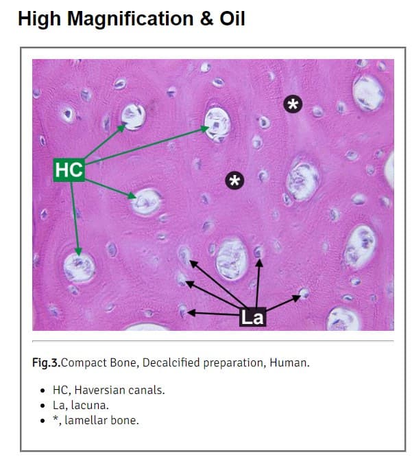 High Magnification & Oil
HC
*
La
*
Fig.3.Compact Bone, Decalcified preparation, Human.
• HC, Haversian canals.
• La, lacuna.
• *, lamellar bone.