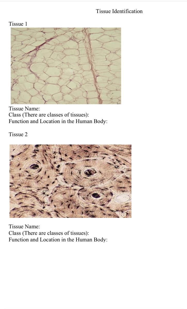 Tissue 1
Tissue Identification
Tissue Name:
Class (There are classes of tissues):
Function and Location in the Human Body:
Tissue 2
Tissue Name:
Class (There are classes of tissues):
Function and Location in the Human Body:
