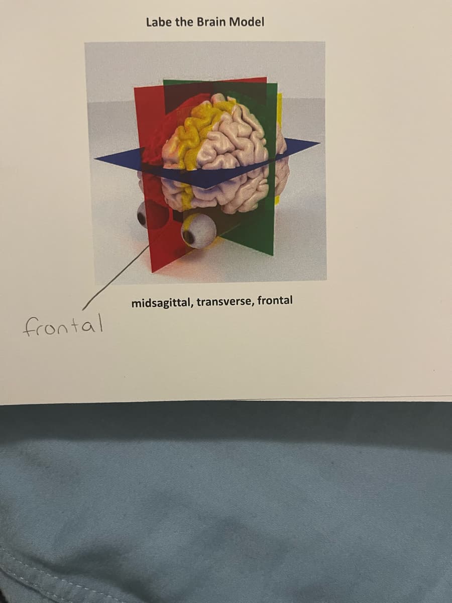 frontal
Labe the Brain Model
midsagittal, transverse, frontal