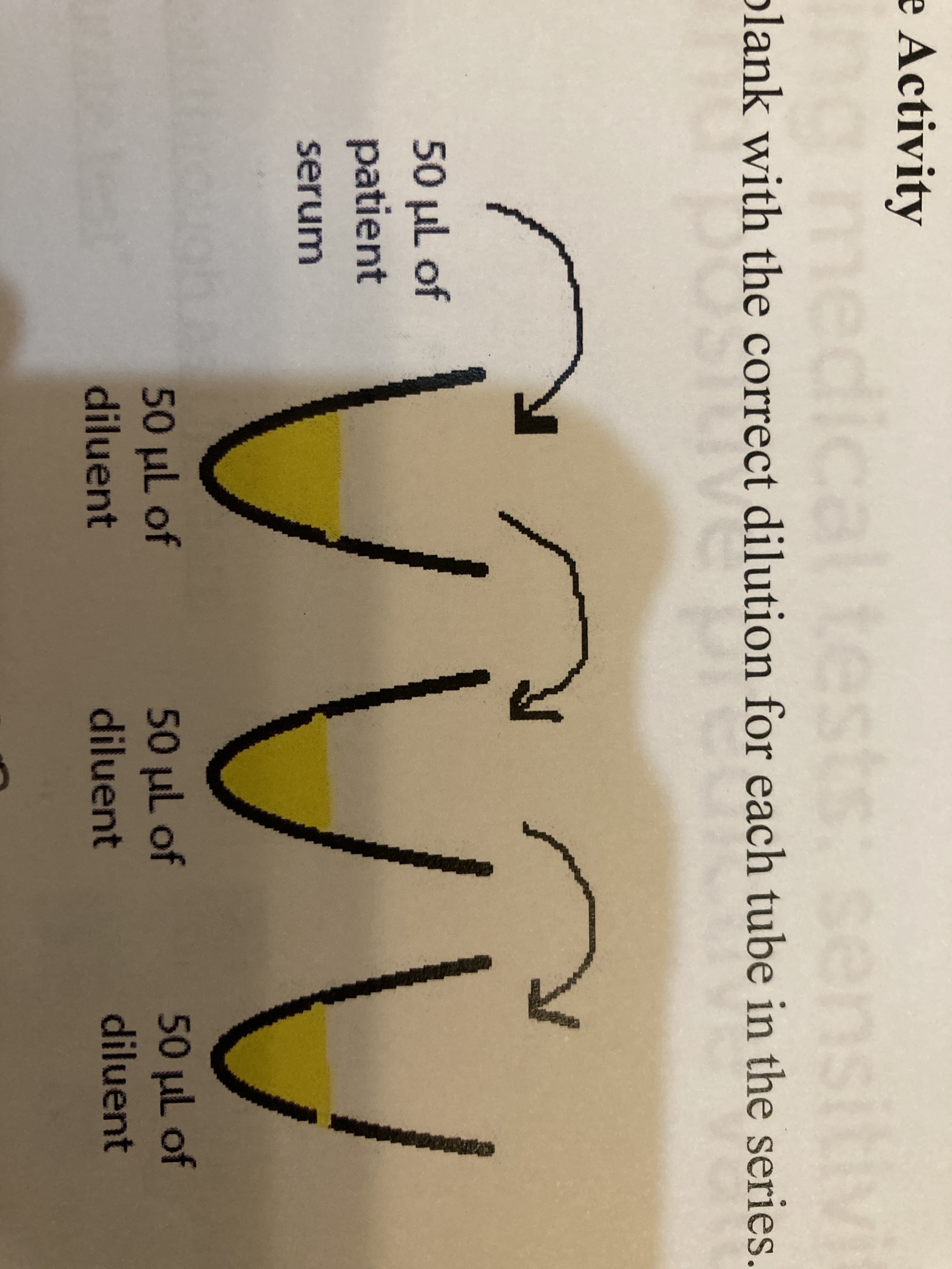 nsitlv
plank with the correct dilution for each tube in the series.
e Activity
amedical tests: se
e correcet
50 ul of
patient
serum
50 µl of
diluent
50 uL of
diluent
50 µL of
diluent
