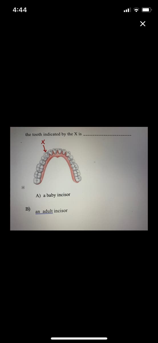 4:44
the tooth indicated by the X is
国
A) a baby incisor
B)
an adult incisor
