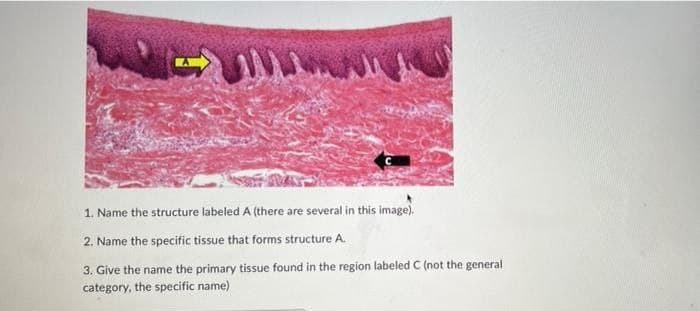 1. Name the structure labeled A (there are several in this image).
2. Name the specific tissue that forms structure A.
3. Give the name the primary tissue found in the region labeled C (not the general
category, the specific name)
