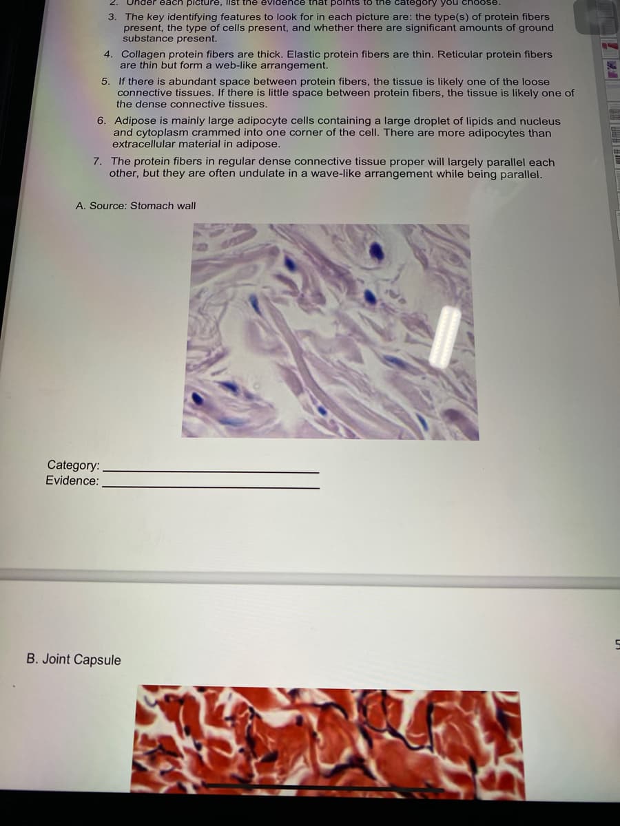 Under each picture, list the eviden
that polnts to the category you choose.
3. The key identifying features to look for in each picture are: the type(s) of protein fibers
present, the type of cells present, and whether there are significant amounts of ground
substance present.
4. Collagen protein fibers are thick. Elastic protein fibers are thin. Reticular protein fibers
are thin but form a web-like arrangement.
5. If there is abundant space between protein fibers, the tissue is likely one of the loose
connective tissues. If there is little space between protein fibers, the tissue is likely one of
the dense connective tissues.
6. Adipose is mainly large adipocyte cells containing a large droplet of lipids and nucleus
and cytoplasm crammed into one corner of the cell. There are more adipocytes than
extracellular material in adipose.
7. The protein fibers in regular dense connective tissue proper will largely parallel each
other, but they are often undulate in a wave-like arrangement while being parallel.
A. Source: Stomach wall
Category:
Evidence:
B. Joint Capsule
