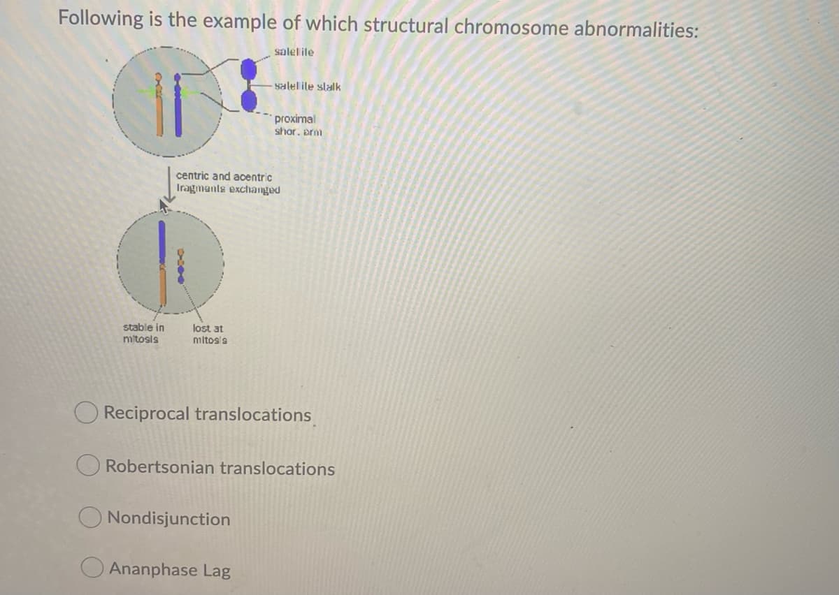 Following is the example of which structural chromosome abnormalities:
salelile
- salelile slalk
proximal
shor. prm
centric and acentric
Iragmante exchanged
stable in
mitosis
lost at
mitos's
Reciprocal translocations
Robertsonian translocations
Nondisjunction
Ananphase Lag

