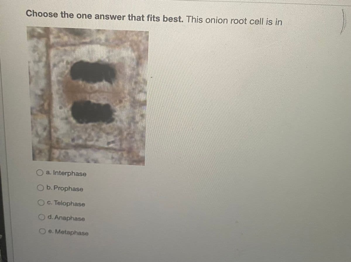 Choose the one answer that fits best. This onion root cell is in
Oa. Interphase
O b. Prophase
c. Telophase
d. Anaphase
e. Metaphase
