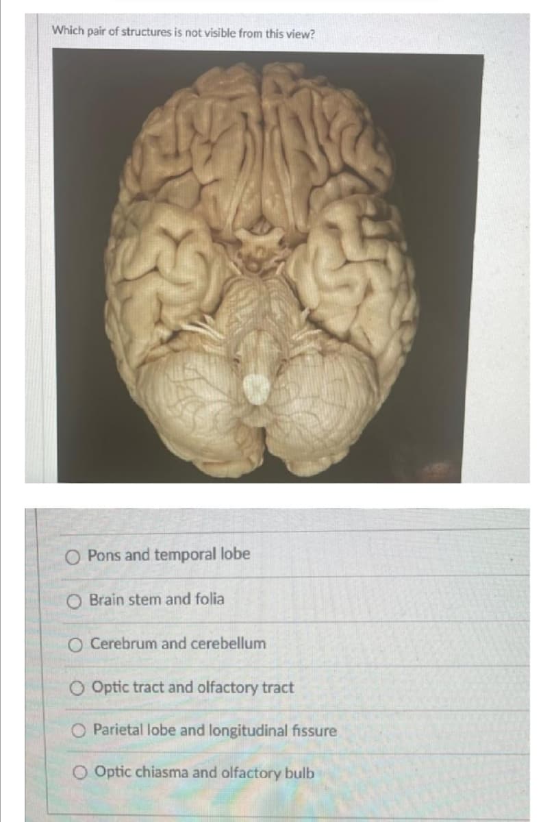 Which pair of structures is not visible from this view?
Pons and temporal lobe
O Brain stem and folia
O Cerebrum and cerebellum
Optic tract and olfactory tract
Parietal lobe and longitudinal fissure
O Optic chiasma and olfactory bulb