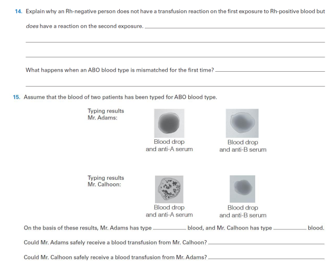14. Explain why an Rh-negative person does not have a transfusion reaction on the first exposure to Rh-positive blood but
does have a reaction on the second exposure.
What happens when an ABO blood type is mismatched for the first time?
15. Assume that the blood of two patients has been typed for ABO blood type.
Typing results
Mr. Adams:
Blood drop
and anti-A serum
Blood drop
and anti-B serum
Typing results
Mr. Calhoon:
Blood drop
and anti-A serum
Blood drop
and anti-B serum
On the basis of these results, Mr. Adams has type.
blood, and Mr. Calhoon has type
blood.
Could Mr. Adams safely receive a blood transfusion from Mr. Calhoon?.
Could Mr. Calhoon safely receive a blood transfusion from Mr. Adams?
