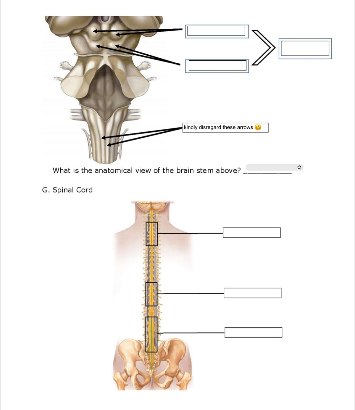 kindly disregard these arrows
What is the anatomical view of the brain stem above?
G. Spinal Cord
