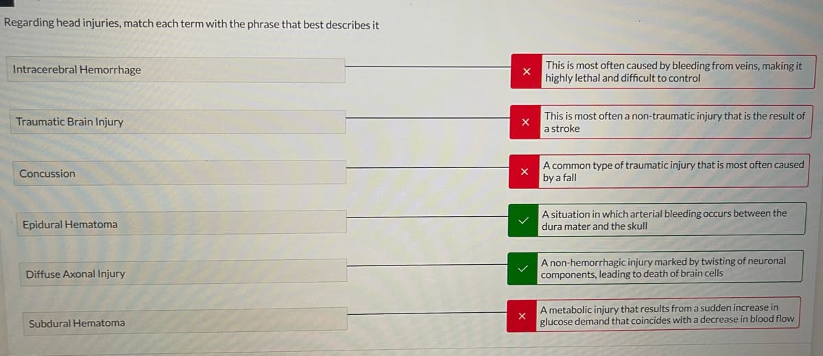 Regarding head injuries, match each term with the phrase that best describes it
Intracerebral Hemorrhage
Traumatic Brain Injury
Concussion
Epidural Hematoma
Diffuse Axonal Injury
Subdural Hematoma
This is most often caused by bleeding from veins, making it
highly lethal and difficult to control
X
This is most often a non-traumatic injury that is the result of
a stroke
A common type of traumatic injury that is most often caused
by a fall
A situation in which arterial bleeding occurs between the
dura mater and the skull
A non-hemorrhagic injury marked by twisting of neuronal
components, leading to death of brain cells
A metabolic injury that results from a sudden increase in
glucose demand that coincides with a decrease in blood flow