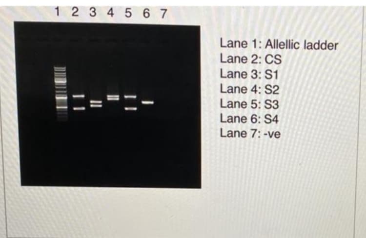 1 2 3 4 5 6 7
Lane 1: Allellic ladder
Lane 2: CS
Lane 3: S1
Lane 4: S2
Lane 5: S3
Lane 6: S4
Lane 7: -ve
