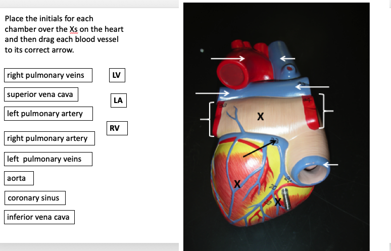 Place the initials for each
chamber over the Xs on the heart
and then drag each blood vessel
to its correct arrow.
right pulmonary veins
LV
superior vena cava
LA
left pulmonary artery
X
RV
right pulmonary artery
left pulmonary veins
aorta
coronary sinus
inferior vena cava

