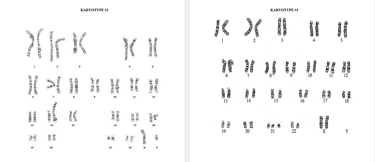 KARYOTYPE #2
KARYOTYPE #3
6.
10
12
13
14
15
16
17
18
富
16
17
18
19
21
Y
21
22
一
4.
9,
3.
and
%3D
243
