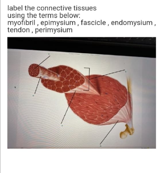label the connective tissues
using the terms below:
myofibril , epimysium , fascicle , endomysium ,
tendon , perimysium
