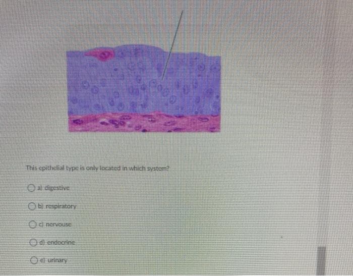 This epithelial type is only located in which system
O dgestive
Ob respiratory
Od nervo
O endocrine
Oe urinary
