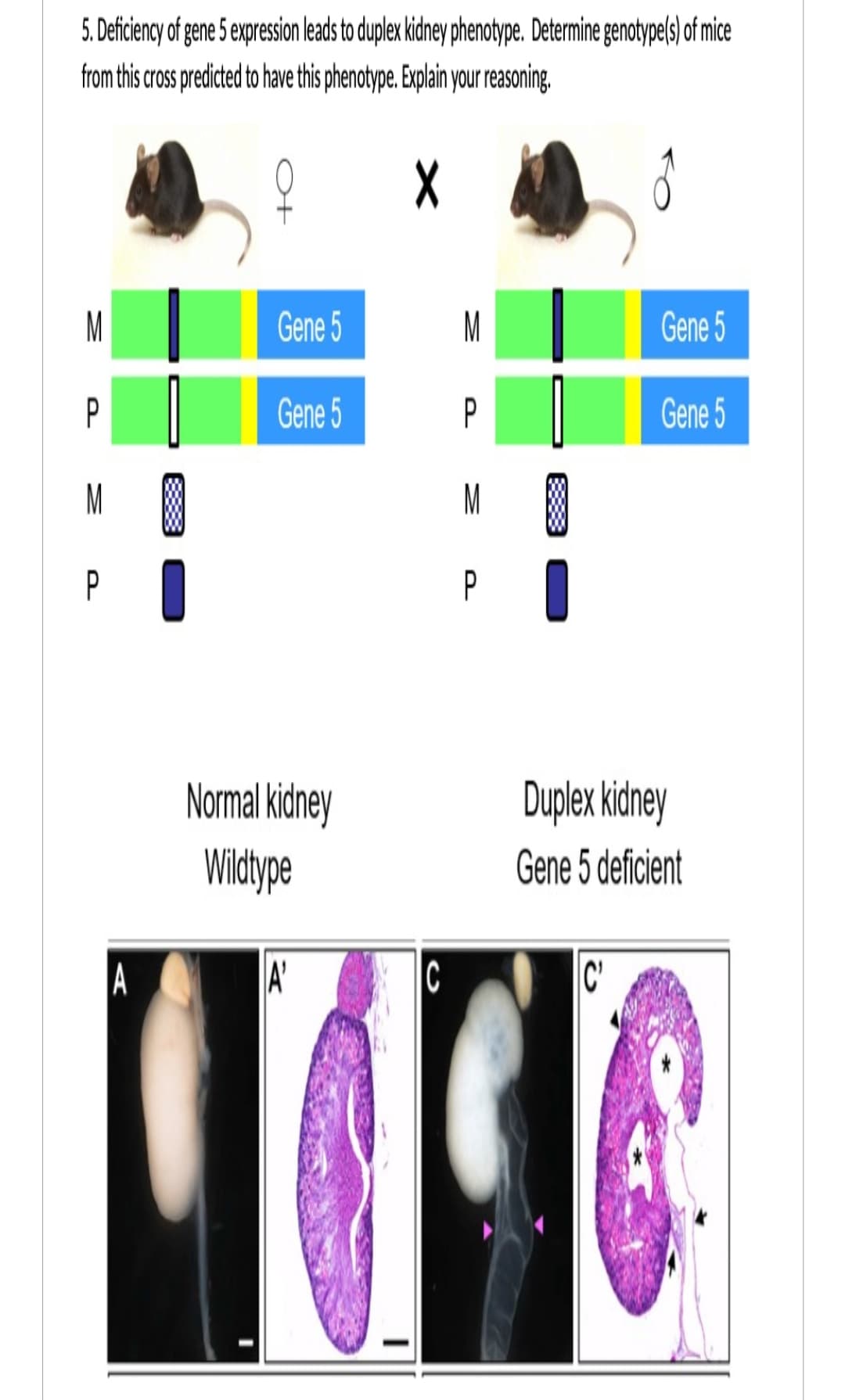 5. Deficiency of gene 5 expression leads to duplex kidney phenotype. Determine genotype(s) of mice
from this cross predicted to have this phenotype. Explain your reasoning.
Q
X
P
P
A
Gene 5
Gene 5
Normal kidney
Wildtype
A'
C
>
P
M
P
Gene 5
C'
Gene 5
Duplex kidney
Gene 5 deficient