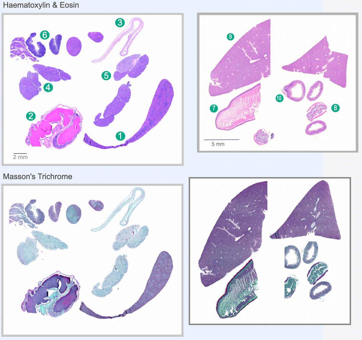 Haematoxylin & Eosin
6
50
2
2 mm
4
Masson's Trichrome
5
3
1
7
5 mm
9
10
00
DO
18
8