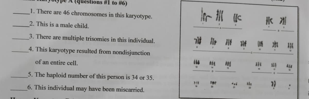 (questions #1 to #6)
I7那
1. There are 46 chromosomes in this karyotype.
张 湖
2. This is a male child.
3. There are multiple trisomies in this individual.
出
4. This karyotype resulted from nondisjunction
of an entire cell.
13
5. The haploid number of this person is 34 or 35.
21
6. This individual may have been miscarried.
