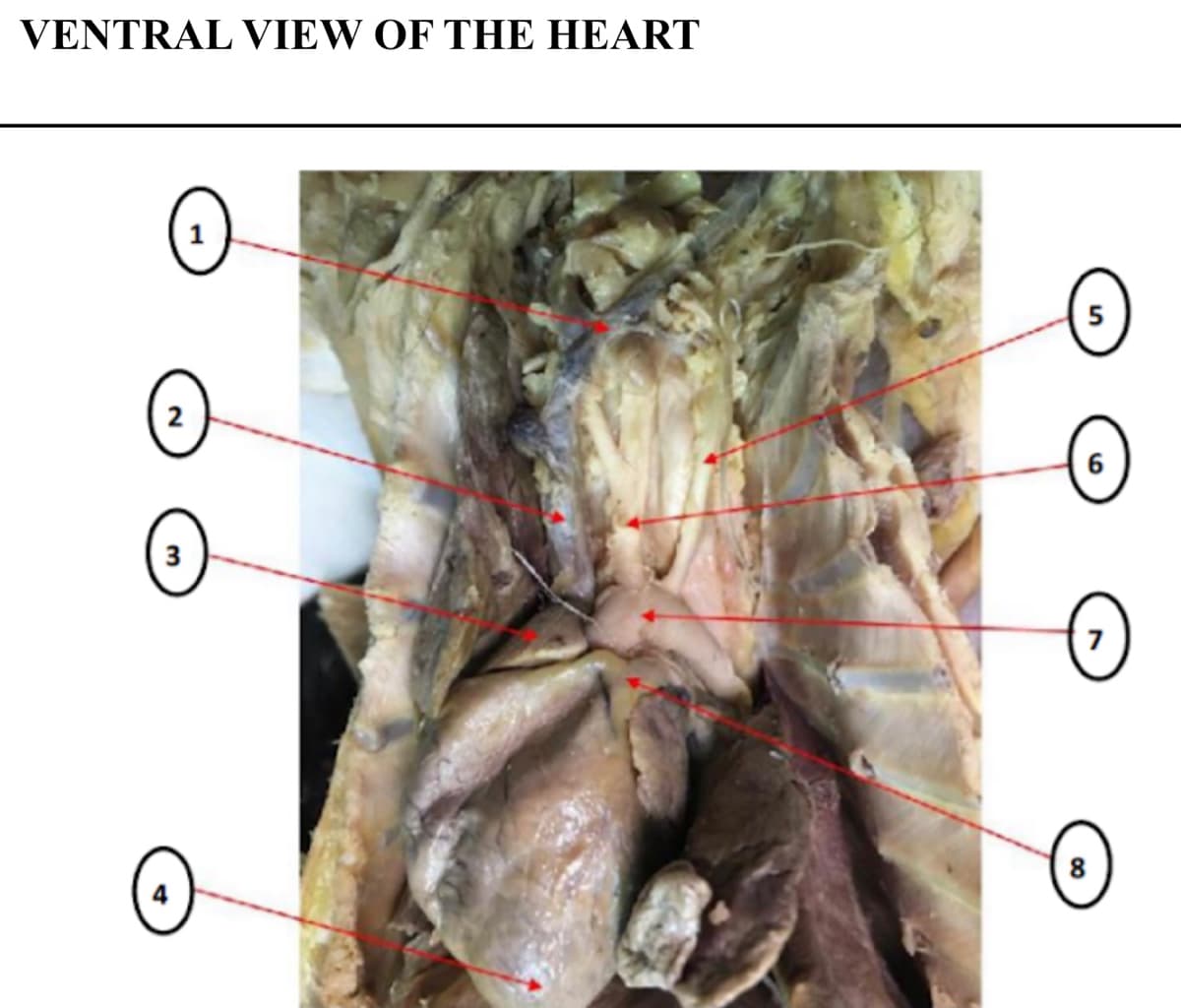 VENTRAL VIEW OF THE HEART
5
2
3
