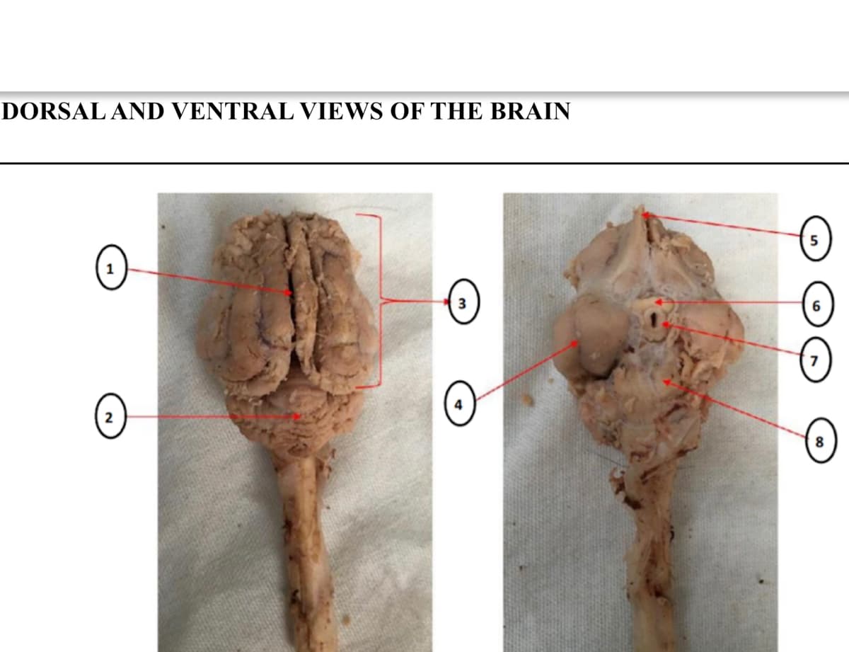 DORSAL AND VENTRAL VIEWS OF THE BRAIN
5
8.
