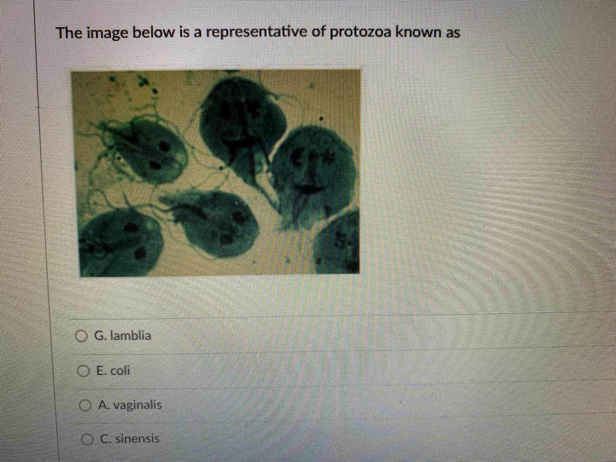 The image below is a representative of protozoa known as
G. lamblia
O E. coli
O A. vaginalis
O C. sinensiis
