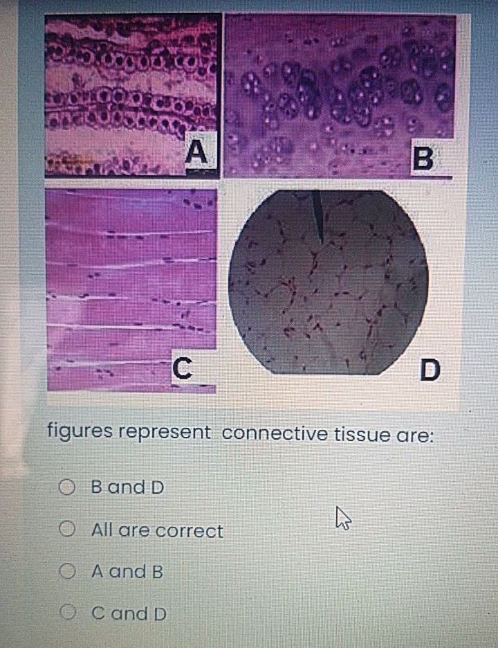 A
figures represent connective tissue are:
O B and D
All are correct
O A and B
O C and D

