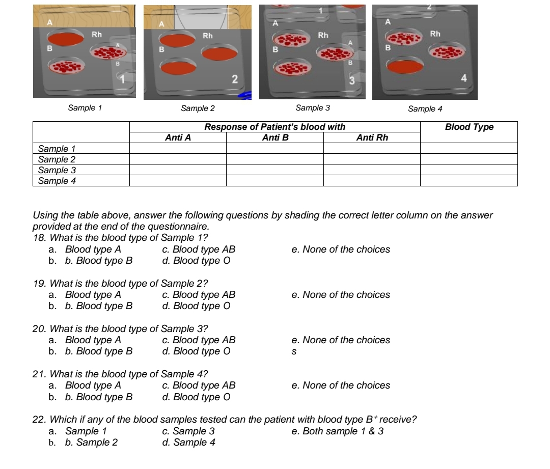 Rh
Rh
Rh
Rh
Sample 1
Sample 2
Sample 3
Sample 4
Blood Type
Response of Patient's blood with
Anti B
Anti A
Anti Rh
Sample 1
Sample 2
Sample 3
Sample 4
Using the table above, answer the following questions by shading the correct letter column on the answer
provided at the end of the questionnaire.
18. What is the blood type of Sample 1?
a. Blood type A
b. b. Blood type B
с. Blood type АB
d. Blood type O
e. None of the choices
19. What is the blood type of Sample 2?
a. Blood type A
b. b. Blood type B
с. Blood type АВ
d. Blood type O
e. None of the choices
20. What is the blood type of Sample 3?
a. Blood type A
b. b. Blood type B
с. Blood type АB
d. Blood type O
e. None of the choices
21. What is the blood type of Sample 4?
a. Blood type A
b. b. Blood type B
e. None of the choices
С. Blood type АВ
d. Blood type O
22. Which if any of the blood samples tested can the patient with blood type B* receive?
а. Sample 1
b. b. Sample 2
c. Sample 3
d. Sample 4
e. Both sample 1 & 3
