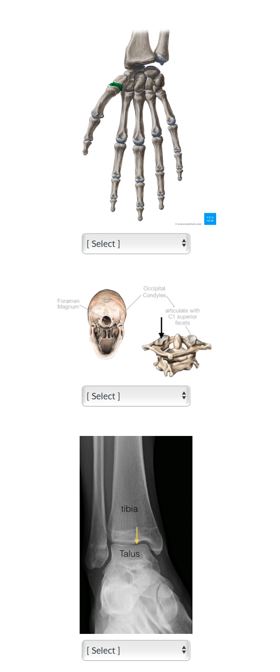 [ Select ]
Occipital
Condyles
Foramen
Magnum
articulate with
C1 superior
facets
[ Select ]
tibia
Talus
[ Select ]

