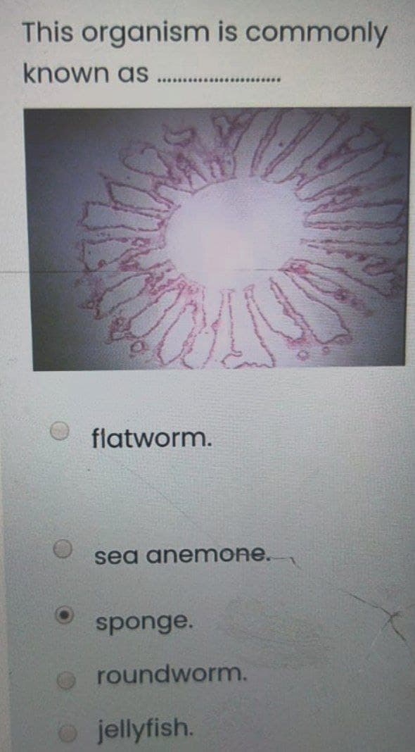 This organism is commonly
known as
flatworm.
sea anemone.
sponge.
roundworm.
o jellyfish.
