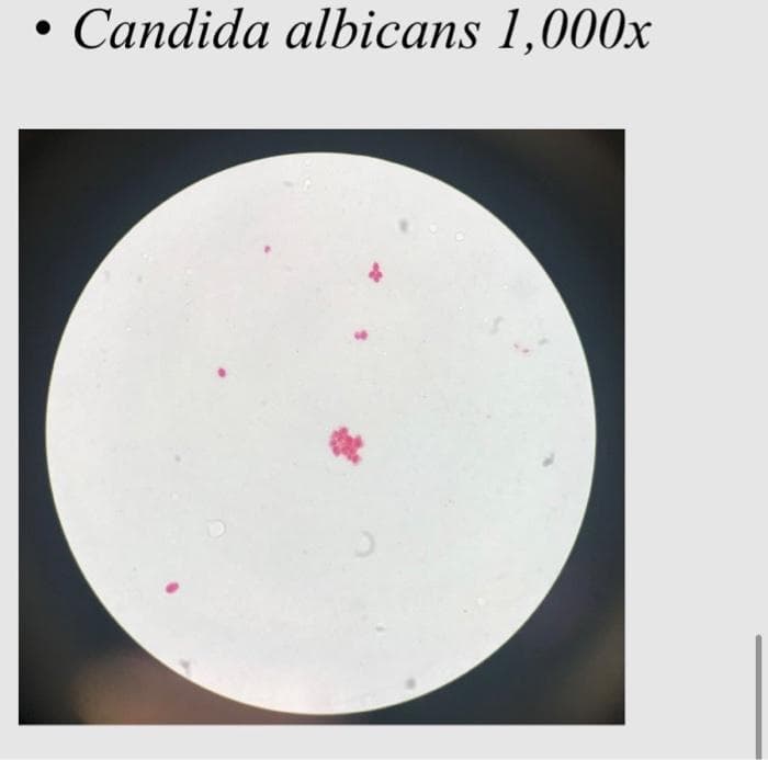 Candida albicans 1,000x