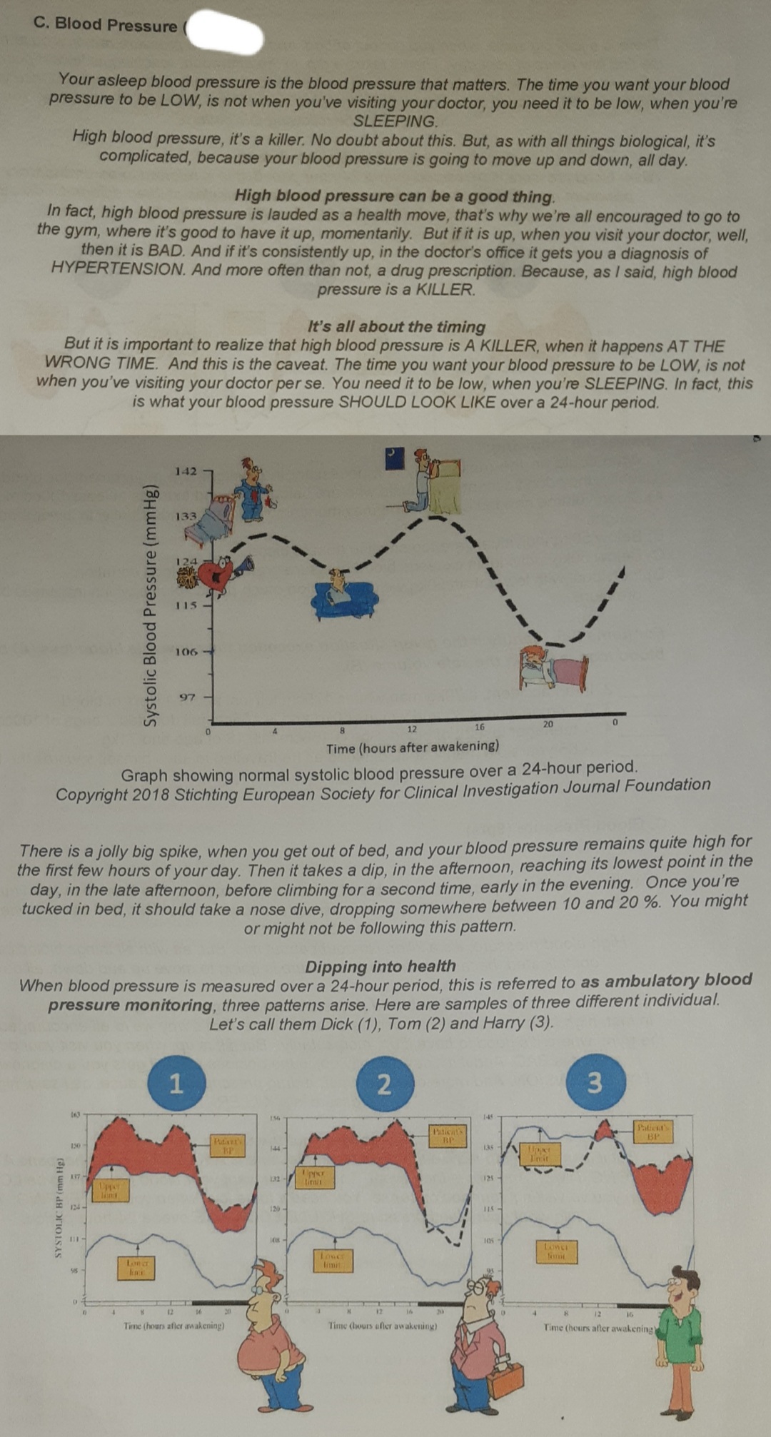 C. Blood Pressure
Your asleep blood pressure is the blood pressure that matters. The time you want your blood
pressure to be LOW, is not when you've visiting your doctor, you need it to be low, when you're
SLEEPING.
High blood pressure, it's a killer. No doubt about this. But, as with all things biological, it's
complicated, because your blood pressure is going to move up and down, all day.
High blood pressure can be a good thing.
In fact, high blood pressure is lauded as a health move, that's why we're all encouraged to go to
the gym, where it's good to have it up, momentarily. But if it is up, when you visit your doctor, well,
then it is BAD. And if it's consistently up, in the doctor's office it gets you a diagnosis of
HYPERTENSION. And more often than not, a drug prescription. Because, as I said, high blood
pressure is a KILLER.
It's all about the timing
But it is important to realize that high blood pressure is A KILLER, when it happens AT THE
WRONG TIME. And this is the caveat. The time you want your blood pressure to be LOW, is not
when you've visiting your doctor per se. You need it to be low, when you're SLEEPING. In fact, this
is what your blood pressure SHOULD LOOK LIKE over a 24-hour period.
142
133
115
106
97
16
20
12
Time (hours after awakening)
Graph showing normal systolic blood pressure over a 24-hour period.
Copyright 2018 Stichting European Society for Clinical Investigation Journal Foundation
There is a jolly big spike, when you get out of bed, and your blood pressure remains quite high for
the first few hours of your day. Then it takes a dip, in the afternoon, reaching its lowest point in the
day, in the late afternoon, before climbing for a second time, early in the evening. Once you're
tucked in bed, it should take a nose dive, dropping somewhere between 10 and 20 %. You might
or might not be following this pattern.
Dipping into health
When blood pressure is measured over a 24-hour period, this is referred to as ambulatory blood
pressure monitoring, three patterns arise. Here are samples of three different individual.
Let's call them Dick (1), Tom (2) and Harry (3).
1
3
Patiest's
BP
Pticats
Pudiver's
BP
130
144
135
Init
pper
tin
A17
132
125
Upper
lint
124-
120
18-
Lonci
timit
Lowe
limit
Loner
55
12
16
12
20
16
Time (hours afler awakening)
Time (hours afler awakening)
Time (hours after awakening)
SYSTOLIC BP (mm Hg)
Systolic Blood Pressure (mmHg)
2)
