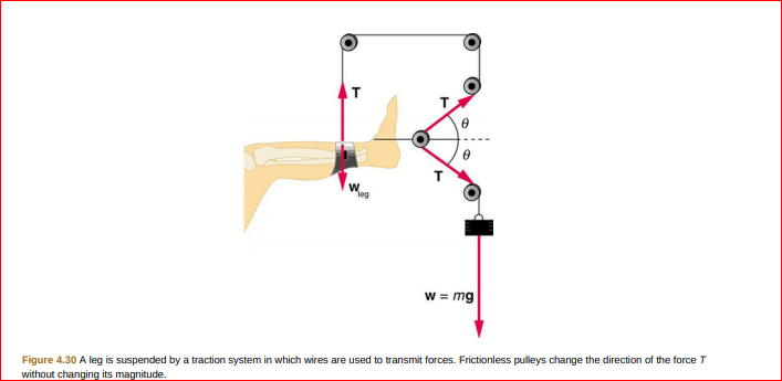 leg
w = mg
Figure 4.30 A leg is suspended by a traction system in which wires are used to transmit forces. Frictionless pulleys change the direction of the force T
without changing its magnitude.
