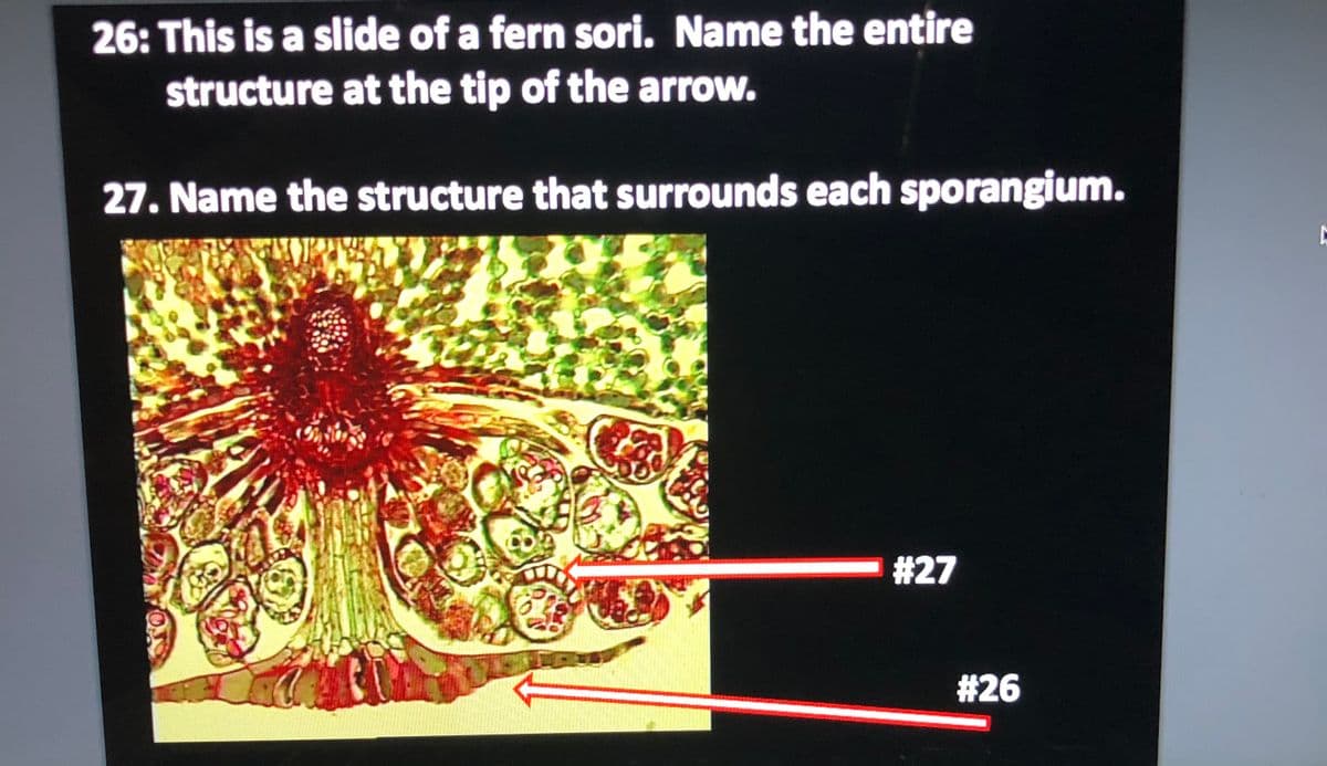 26: This is a slide of a fern sori. Name the entire
structure at the tip of the arrow.
27. Name the structure that surrounds each sporangium.
#27
#26
